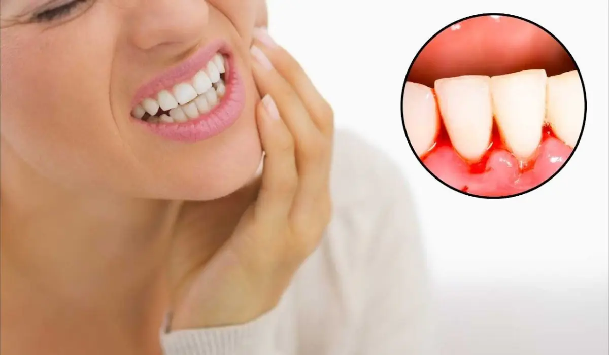 How Much Does a Smile Makeover Cost in the UK? 
